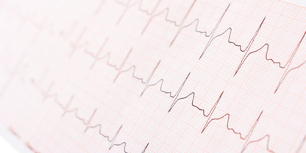 Badania laboratoryjne w chorobach serca